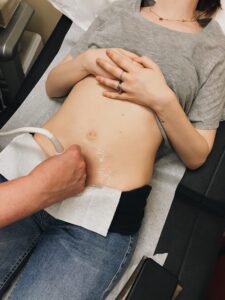Doctor conducting an ultrasound of a mothers tummy in her first trimester